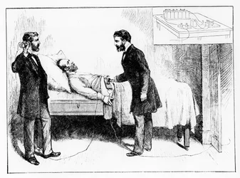 Il presidente Garfield con un proiettile non rilevato, 1881